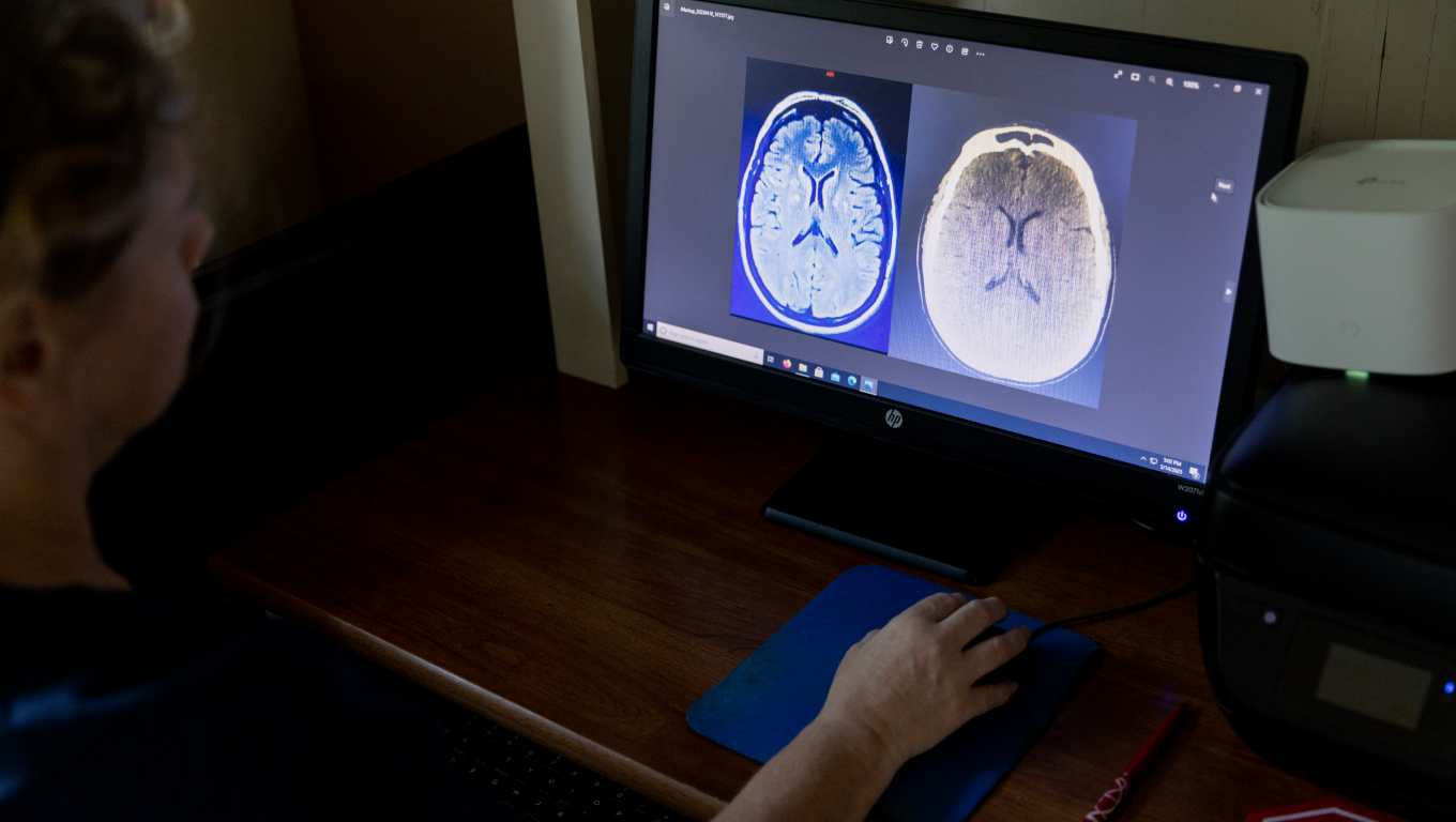 Heather Payne shares an MRI and CT scan after her strokes. MUST CREDIT: Kendrick Brinson/For The Washington Post